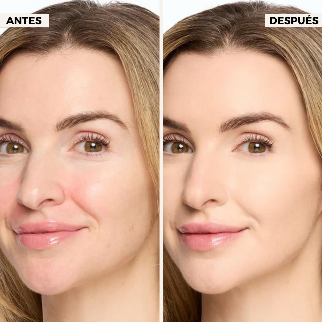 Solena® Undereye Corrector
