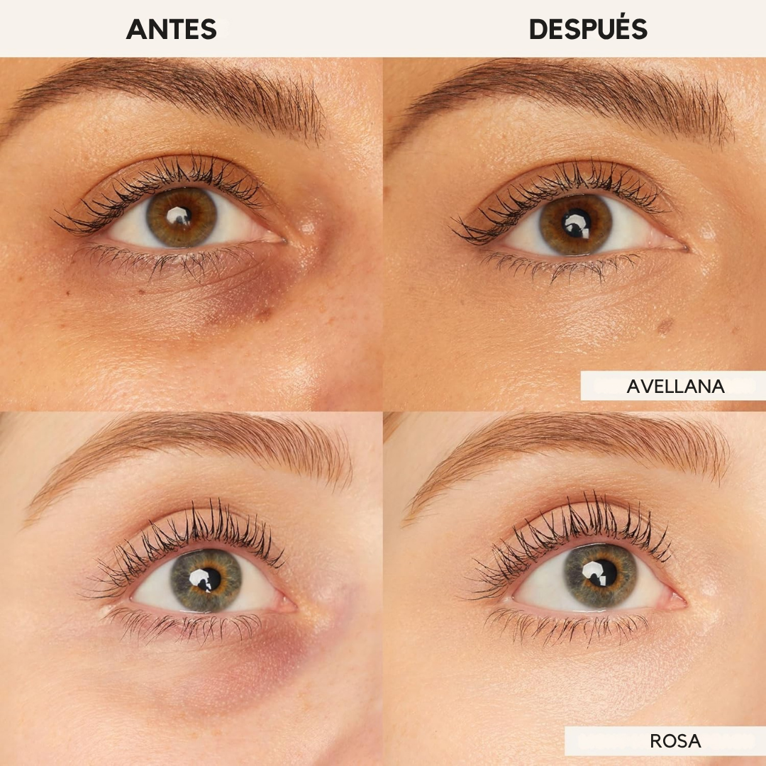 Solena® Undereye Corrector